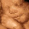 3D Ultrasound Baby Sleeping