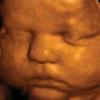 Ultrasound Baby Sleeping