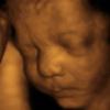 Ultrasound Baby Sleeping