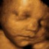Ultrasound Baby5